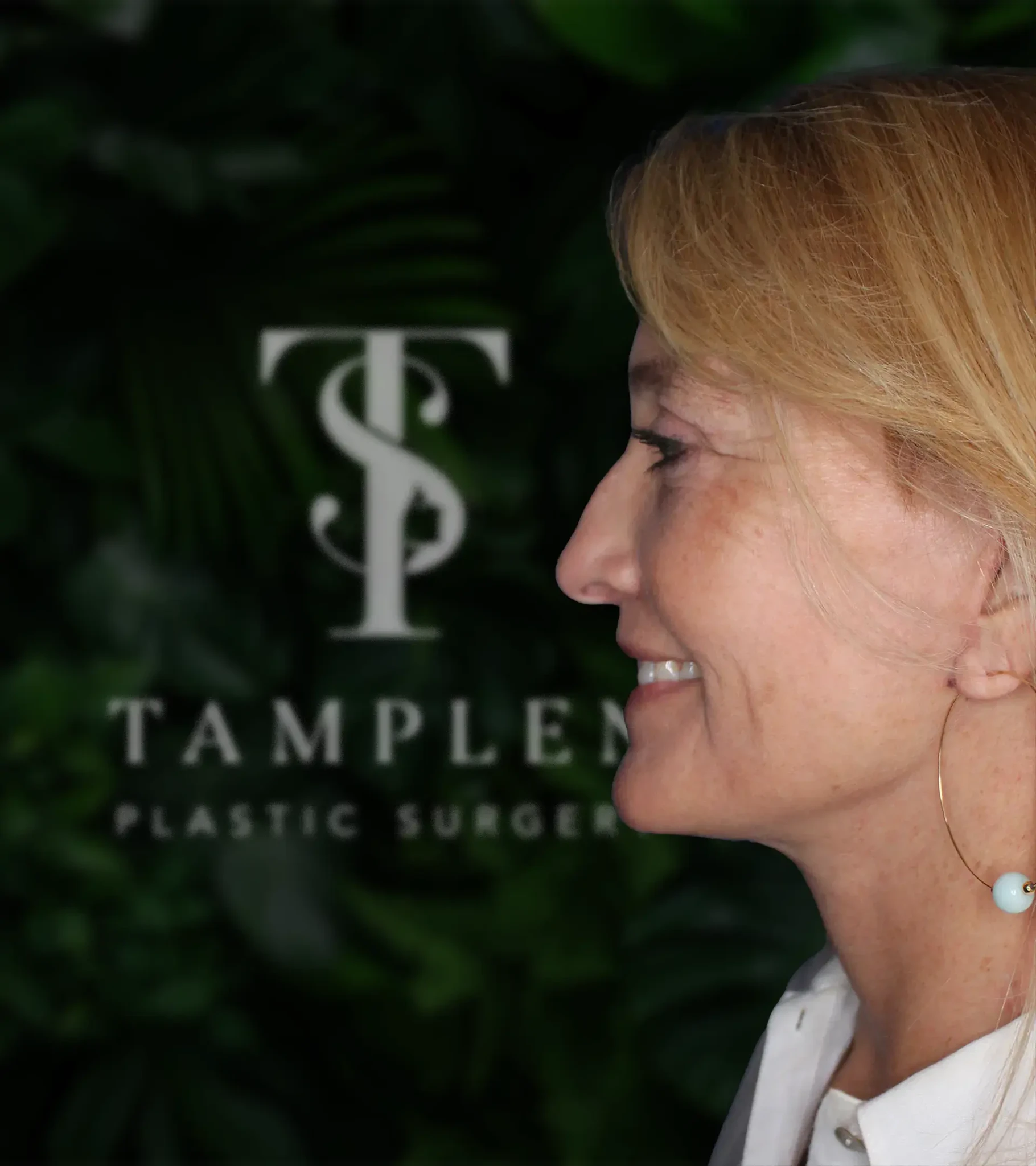 Female patient neck lift results at Tamplen Plastic Surgery