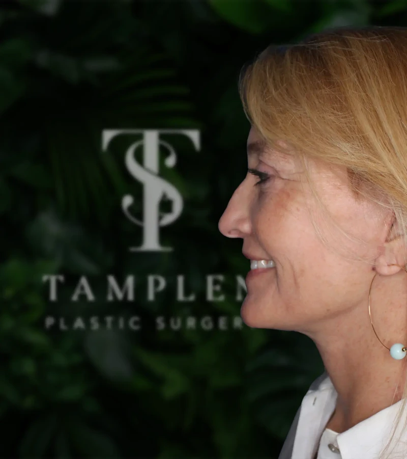 Female patient neck lift results at Tamplen Plastic Surgery